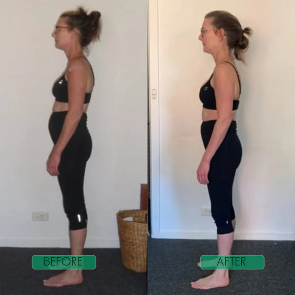 Nova Posture Corrector