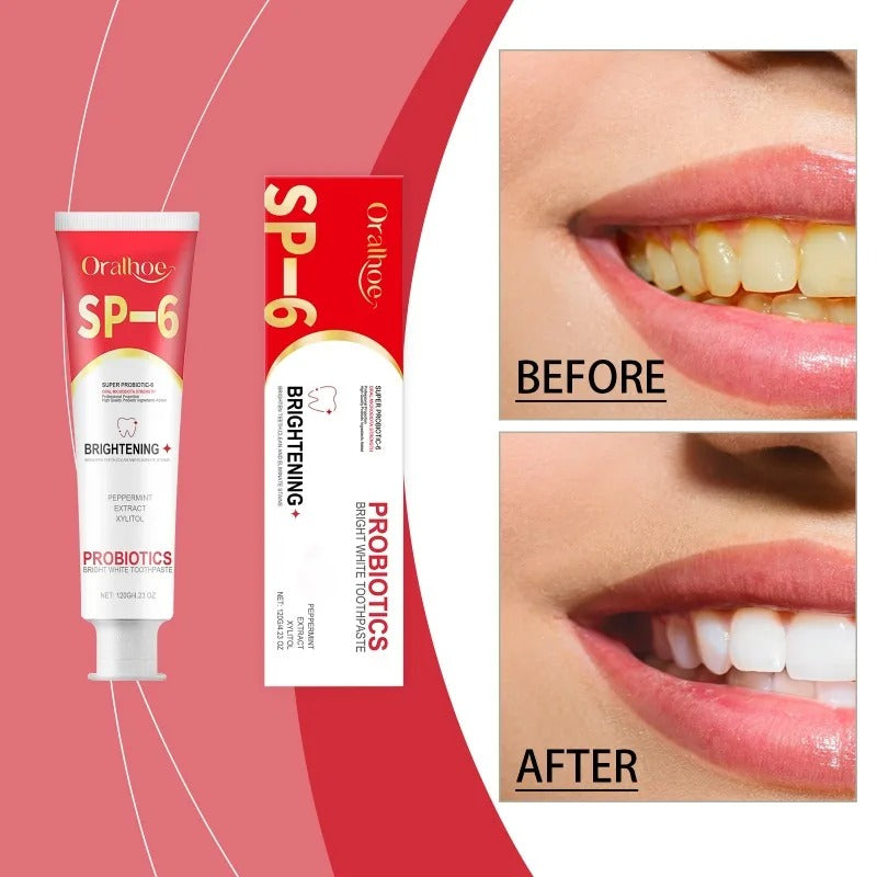 Hydroxyapatite probiotic toothpaste